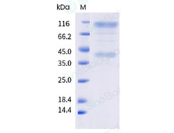 Sino Biological&nbsp;Recombinant Human CCR5 Protein (Flag & His-Strep Tag), Detergent