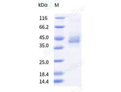 Sino Biological&nbsp;Recombinant Human CCR5 Protein (Nanodisc, Flag-Strep & His tag)