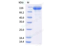 Sino Biological&nbsp;Recombinant Human IL-12 R beta 1/IL12RB1 Protein (ECD, hFc Tag)