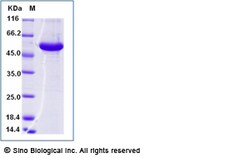 Sino Biological&nbsp;Recombinant Cynomolgus DPEP1 Protein (His & AVI Tag), Avi-tag Biotinylated, HPLC-verified