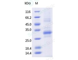 Sino Biological&nbsp;Recombinant Cynomolgus, Rhesus GPRC5D Protein (Nanodisc, His & FLAG Tag)