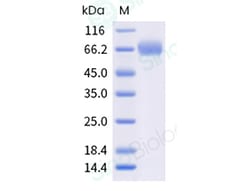 Sino Biological&nbsp;Recombinant Cynomolgus B7-H7/HHLA2 Protein (His Tag), HPLC-verified