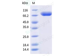 Sino Biological&nbsp;Recombinant Rat TL1A/TNFSF15 Protein (Trimer, His Tag), MALS-verified