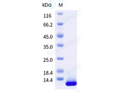 Sino Biological&nbsp;Recombinant Mouse CXCL4/PF4 Protein (His Tag)