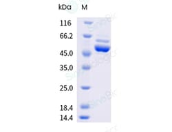 Sino Biological&nbsp;Recombinant Mouse TRIM21 Protein (His & AVI Tag), Avi-tag Biotinylated