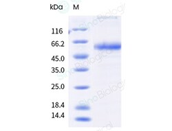 Sino Biological&nbsp;Recombinant Human 4-1BB Ligand/TNFSF9 Protein (His Tag), Trimer, MALS-verified