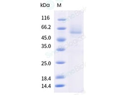 Sino Biological&nbsp;Recombinant Human GLP1R Protein (Nanodisc, Flag-His Tag)