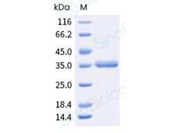 Sino Biological&nbsp;Recombinant Mycoplasma pneumoniae adhesin P1 Protein