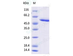 Sino Biological&nbsp;Recombinant Human Calreticulin/CALR Protein (Low Endotoxin)