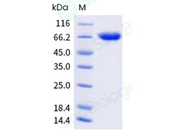 Sino Biological&nbsp;Recombinant Arachis hypogaea Ara h 1 Protein