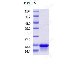 Sino Biological&nbsp;Recombinant Human SAP/SH2D1A Protein (His Tag)