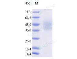 Sino Biological&nbsp;Human MUC-1 Protein (aa890-1158, His Tag), Biotinylated