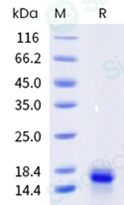 Sino Biological&nbsp;Recombinant Human PDGF-BB Protein (MALS-verified), MALS-verified