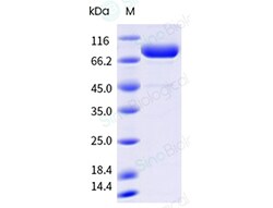 Sino Biological Human TFRC 100ug