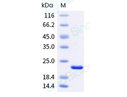 Sino Biological Human vWF 100ug