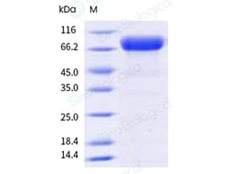 Sino Biological&nbsp;Influenza A H1N1 (A/Victoria/4897/2022) Hemagglutinin / HA-specific B cell probe Protein (Y108F, AVI & His Tag), Biotinylated