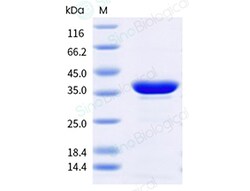 Sino Biological&nbsp;Recombinant Mangifera indica Man i 1 Protein