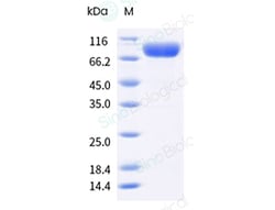 Sino Biological&nbsp;Influenza A H1N1 (A/Wisconsin/588/2019) Hemagglutinin / HA-specific B cell probe Protein (Y108F, AVI & His Tag), Biotinylated