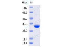 Sino Biological&nbsp;SARS-COV-2 CoV 3CLpro / 3C-like protease Protein