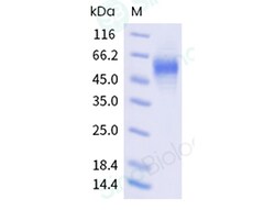 Sino Biological&nbsp;Recombinant Human SLC39A6/LIV-1 Protein (ECD, His Tag)