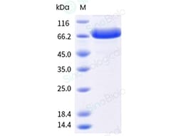 Sino Biological&nbsp;Epstein-Barr virus (strain B95-8) EBV Lytic switch protein BZLF1 Protein (His & MBP Tag)