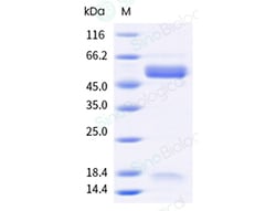 Sino Biological HMPV HMPVF 100ug
