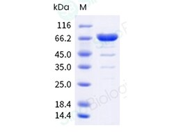 Sino Biological&nbsp;Norovirus GII.4 VP1 Protein (His & MBP Tag)