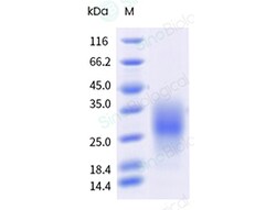 Sino Biological&nbsp;Recombinant Mouse IL-13 Protein (His Tag), HPLC-verified