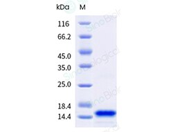 Sino Biological&nbsp;Monkeypox Virus (MPXV) (Clade Ib) Protein A29L (His Tag)