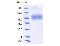 Sino Biological&nbsp;Monkeypox Virus (MPXV) (Clade Ib) Envelope protein E8L Protein (His Tag)