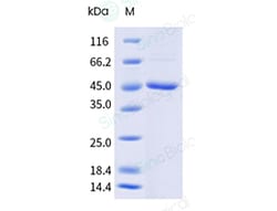 Sino Biological&nbsp;Yellow fever virus (YFV) (strain 17D vaccine) Envelope Protein (His Tag)