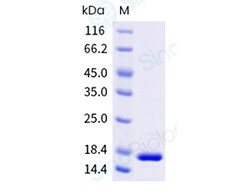 Sino Biological&nbsp;Recombinant Mouse IL-17F Protein