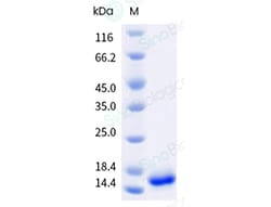 Sino Biological&nbsp;Monkeypox Virus (MPXV) (Clade Ib) Protein A35R (His Tag)