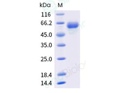 Sino Biological&nbsp;Influenza A H3N2 (A/Massachusetts/18/2022; A/Croatia/10136RV/2023) Neuraminidase / NA Protein (ECD, His Tag)