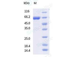 Sino Biological&nbsp;Recombinant Coxsackievirus（CV）A6 VP1 Protein (Fc Tag)