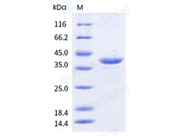Sino Biological&nbsp;Recombinant Human Pepsinogen C/PGC Protein
