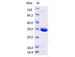 Sino Biological&nbsp;SARS-COV-2 CoV 3CLpro / 3C-like protease Protein (His Tag)