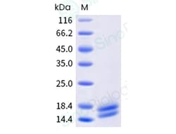 Sino Biological Alternaria alternate ALTA1 250