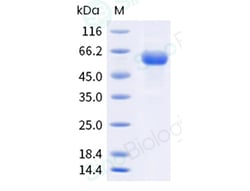 Sino Biological&nbsp;Influenza A H3N2 (A/Thailand/8/2022) Neuraminidase/NA Protein (ECD, His Tag)