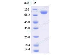 Sino Biological&nbsp;Influenza A H1N1 (A/Victoria/2570/2019) Hemagglutinin / HA-specific B cell probe Protein (Y108F, AVI & His Tag), Biotinylated (HPLC-verified)