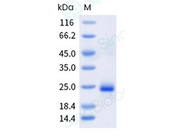 Sino Biological&nbsp;Recombinant Human IL-17F Protein (His & AVI Tag), Biotinylated, HPLC-verified