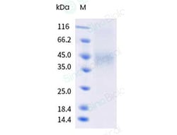 Sino Biological&nbsp;Recombinant Human CCR8 Protein (Nanodisc, Flag-Strep & His tag)