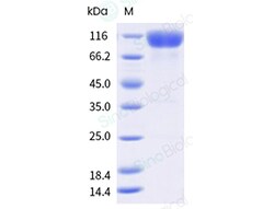 Sino Biological&nbsp;Recombinant Mouse IL-23 Receptor Protein (hFc Tag)
