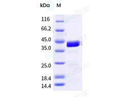 Sino Biological&nbsp;Chikungunya virus (CHIKV) (strain SL-CK1) E2 glycoprotein Protein