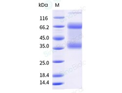 Sino Biological&nbsp;Monkeypox Virus (MPXV) (Clade Ib) Envelope protein E8L Protein (His Tag)