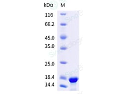 Sino Biological&nbsp;Monkeypox Virus (MPXV) (Clade Ib) L1R Protein (His Tag)