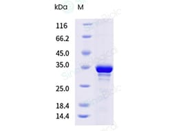 Sino Biological&nbsp;Monkeypox Virus (MPXV) A27L Protein (His Tag)