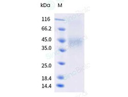 Sino Biological&nbsp;Recombinant Human CCR8 Protein (Nanodisc, Flag-Strep & His tag)
