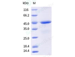 Sino Biological&nbsp;Recombinant Triticum aestivum Tri a 36 Protein