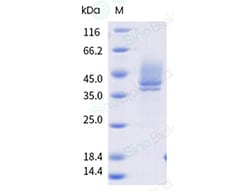 Sino Biological Recombinant Cladosporium cladosporioides Cla c 14 Protein